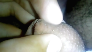 Transariam com o pénis desse jeito? Glanulos de fordyce (não e doença não) nem contagioso