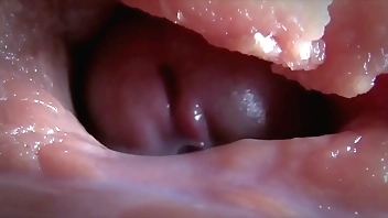 compilacao de esporradelas