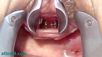 Masturbate Peehole with Toothbrush and Chain into Urethra