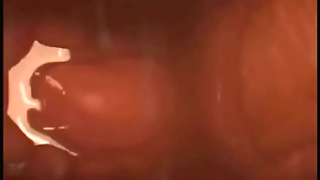 Internal view of Pussy vs Cock