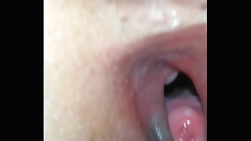 Lồn rộng soi tử cung