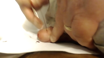 Large Pin through cockhead - b. gushes when extracted